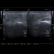 Acute parotitis: US - Ultrasound