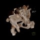 Bone defect after bone graft harvest: CT - Computed tomography