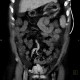 Liver cirrhosis, ascites, portal colonopathy, colopathy: CT - Computed tomography