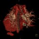 CTEPH, chronic thromboembolic pulmonary arterial hypertension, VRT: CT - Computed tomography
