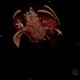 Pyelocystitis, narrowing of calyceal neck: CT - Computed tomography