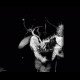 Chronic pancreatitis, dilated pancreatic duct, MRCP: MRI - Magnetic Resonance Imaging