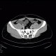 Crohn's disease, postinflammatory changes: CT - Computed tomography