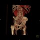 Dilatative form of arteriosclerosis, VRT: CT - Computed tomography