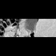 Enteric cyst of duodenum: CT - Computed tomography