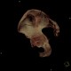Fracture of pelvis, iliac wing, VRT: CT - Computed tomography