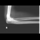 Fracture of capitulum radii: X-ray - Plain radiograph