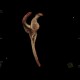 Fracture of scapula, shoulder blade, VRT: CT - Computed tomography