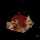 Hemocephalus, ventricular bleeding: CT - Computed tomography