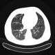 Hypersensitivity pneumonitis, subacute: CT - Computed tomography