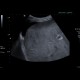 Hepatitis, lues: US - Ultrasound