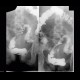 Compression of sigmoid colon: RF - Fluoroscopy