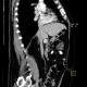 Lipoma in duodenum, small: CT - Computed tomography