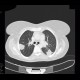 Lymphoma of the lung and spleen: CT - Computed tomography