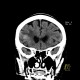 Metastatic disease of the brain: CT - Computed tomography