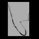 Shunt stenosis, angioplasty: AG - Angiography