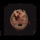 Osteolytic changes of facial skeleton: CT - Computed tomography