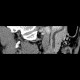 Pancreas divisum on CT, mininum intensity projection, MinIP: CT - Computed tomography