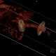 Percutaneous endoscopic gastrostomy, PEG: CT - Computed tomography