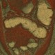 Ulcerative colitis, enterography, VRT: CT - Computed tomography