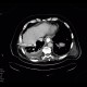 Leak of anastomosis of esophagus in pleural cavity, gastroesophageal anastomosis, stent: CT - Computed tomography