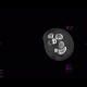 Perilunate luxation: CT - Computed tomography
