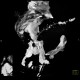 Rectovaginal fistula, VRT: CT - Computed tomography