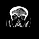 Contusion of frontopolar cortex, beam hardening artifact, subarachonid hemorrhage, follow-up: CT - Computed tomography