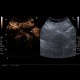 Renal carcinoma, treatment with RFA, follow-up, CEUS: US - Ultrasound