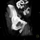 Lung tumour, bone metastasis in pubic bone, inguinal hernia: CT - Computed tomography