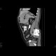 Adrenal tumour, extensive: CT - Computed tomography