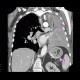 Lung tumour, tumorous infiltration of the lung wing: CT - Computed tomography