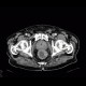 Colorectal cancer, carcinoma of rectum: CT - Computed tomography