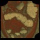 Ulcerative colitis, enterography, VRT: CT - Computed tomography