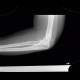 Sail sign, elbow, joint effusion: X-ray - Plain radiograph