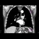 Large Zenker's diverticulum: CT - Computed tomography