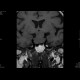 Adenoma of the hypophysis: MRI - Magnetic Resonance Imaging