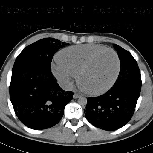 Anemia, heart